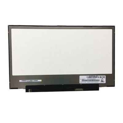 Quadrat Tft des LG Display-141PPI 220cd/M2 zeigen 15.6in LP156WF9-SPM3 an
